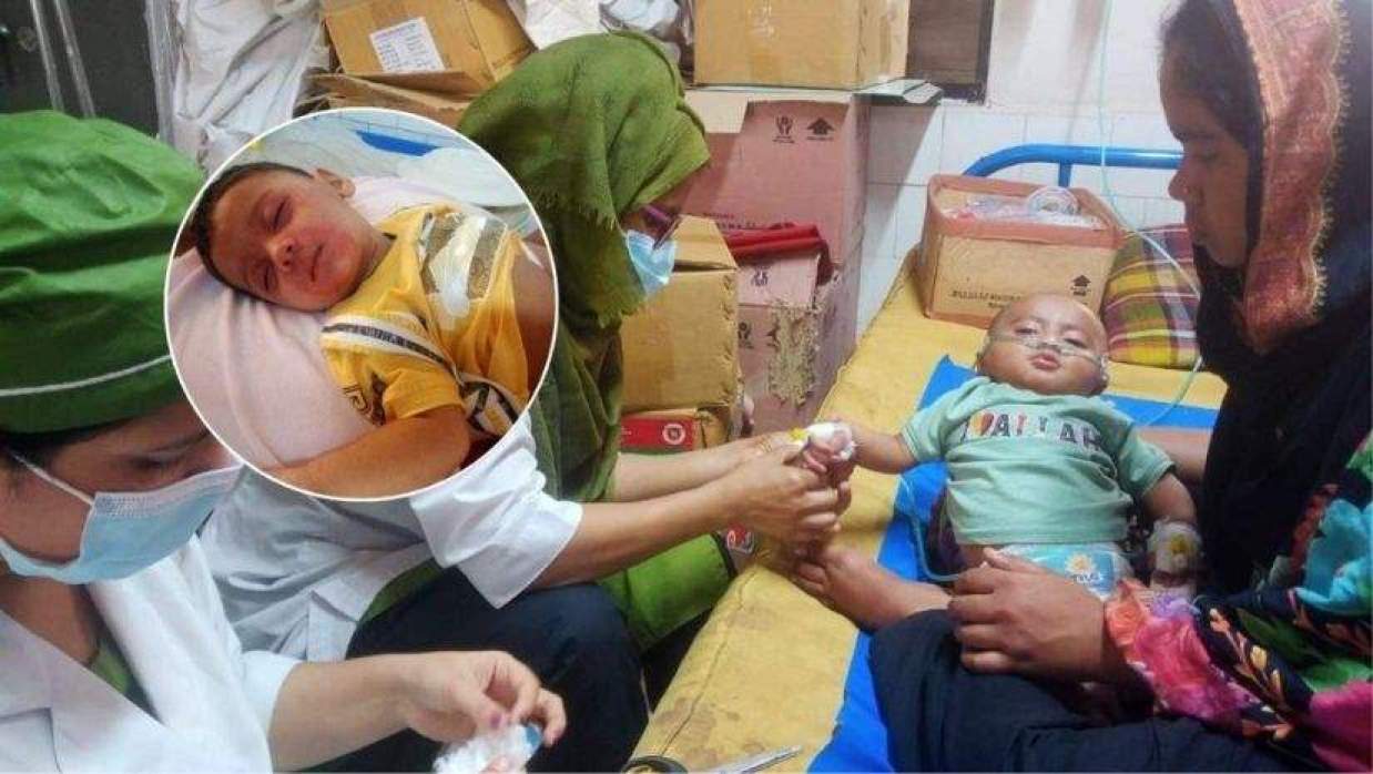 বাংলাদেশে হামের প্রাদুর্ভাব বৃদ্ধি, শিশুদের মৃত্যু বাড়ছে