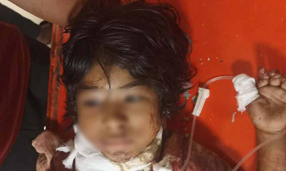 চট্টগ্রামে ইকো-পার্কে গলায় ছুরিকাঘাতে আহত ৭ বছরের শিশু ইরা মারা গেছে